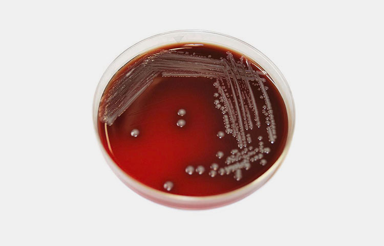 Bacterial strain selection