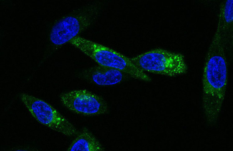 Cholera toxin B subunit
