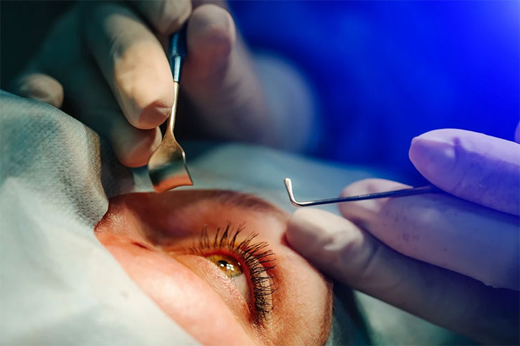 After surgery discomfort
