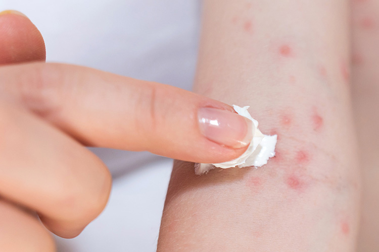 Allergic-reaction