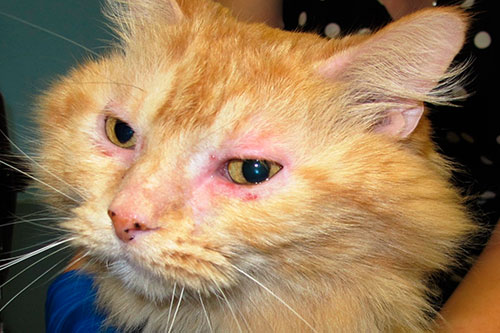 Allergic reactions