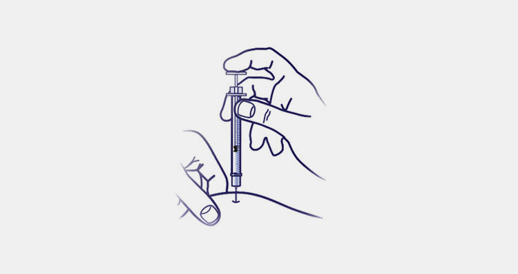 Complete Injection