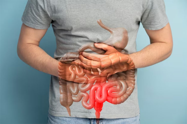 Digestive system disorder