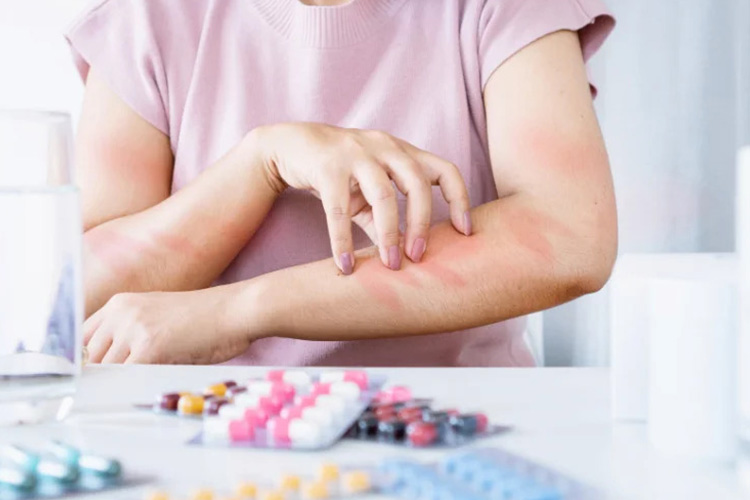 History-of-drug-allergies