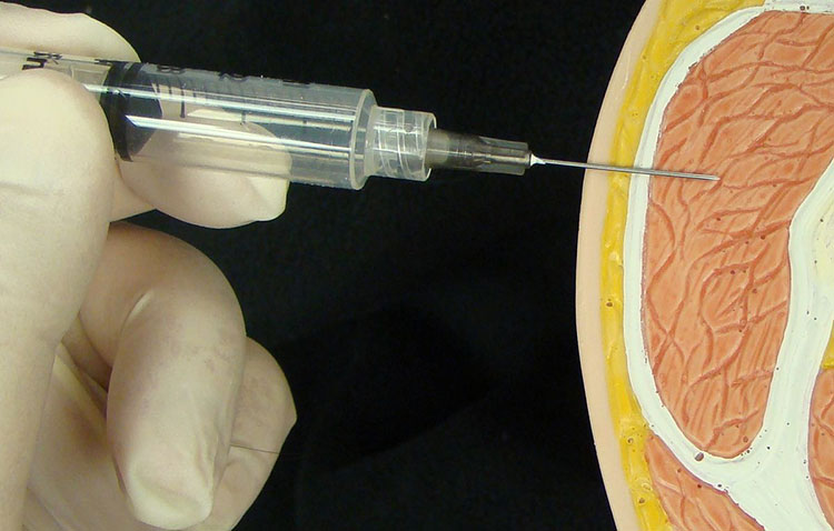 Intramuscular (IM) injection