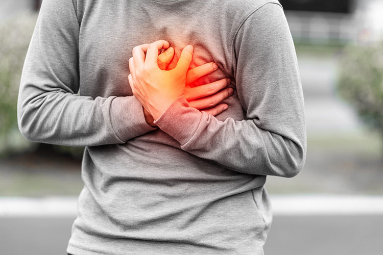 Myocardial infarction