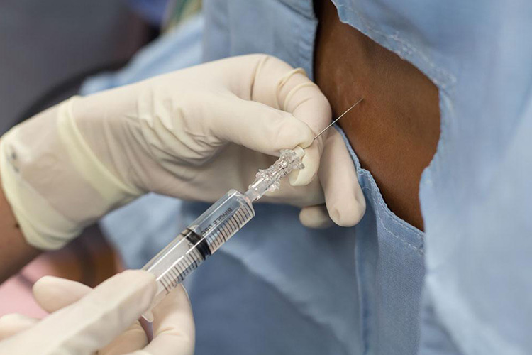 Nerve-block