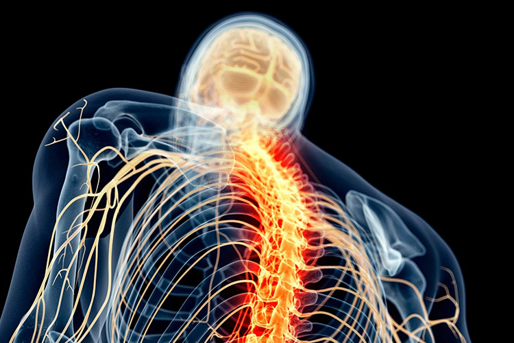 Nervous-system-injury