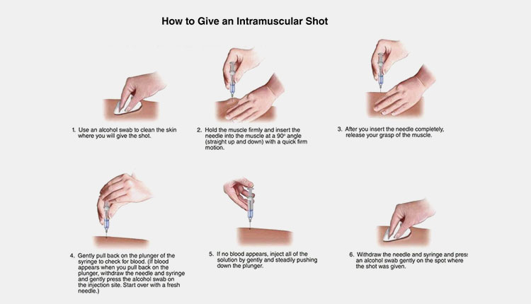 Procedure for injection into intramuscular tissues