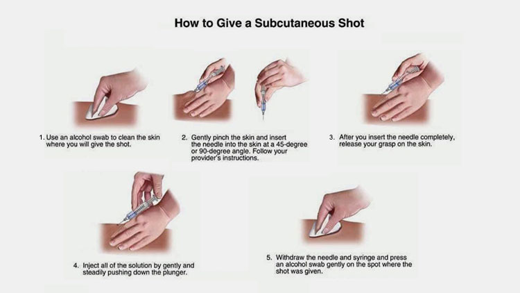 Procedure for injection into subcutaneous tissue