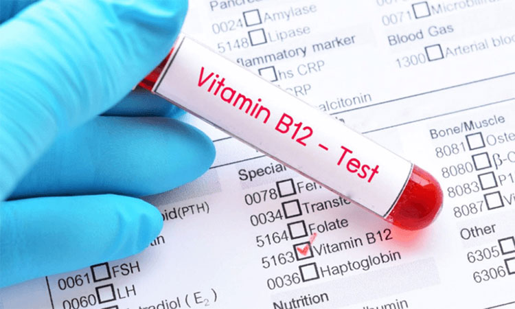 Test the blood levels of cobalamin
