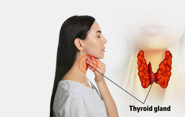 Thyroid disorder