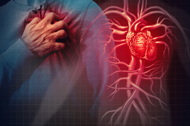 Treating-coronary-heart-disease-and-cerebral-infarction