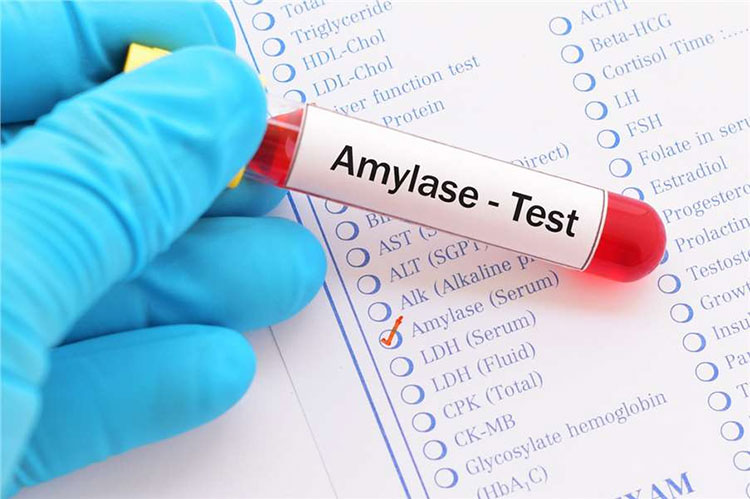 Benefits of enzyme manufacturing