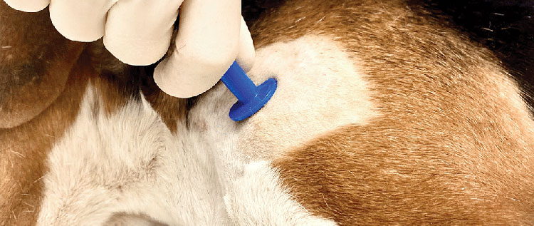 Bone marrow suppression