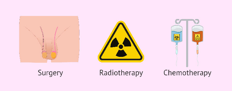 Chemotherapy drugs for testicular cancer-1