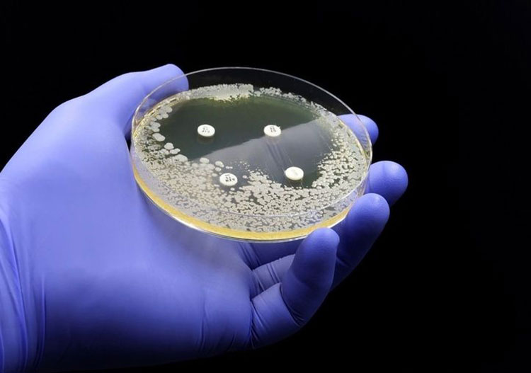 Choice of microbial strain