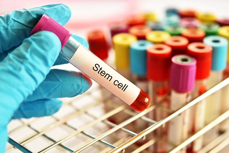 Facilitating cell therapy