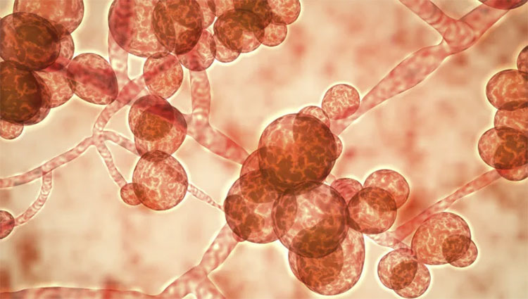 Fungal Infection In Ear