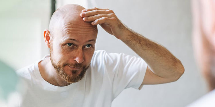Hair loss
