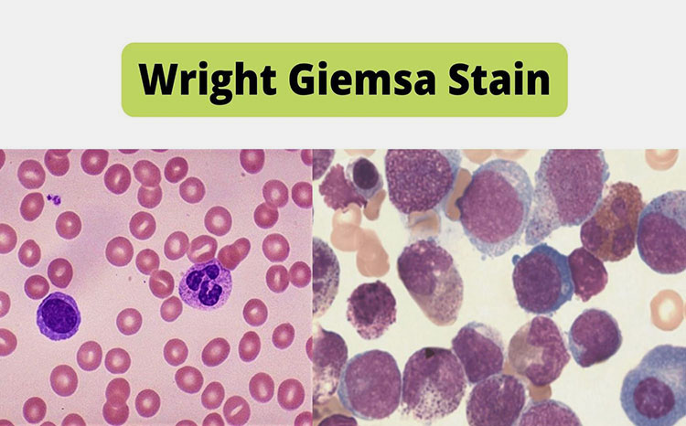 Hematology