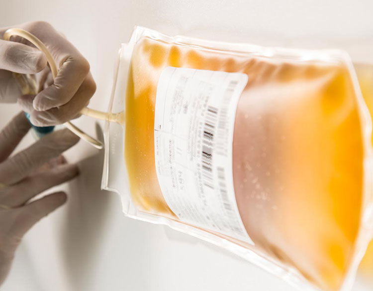 Human plasma