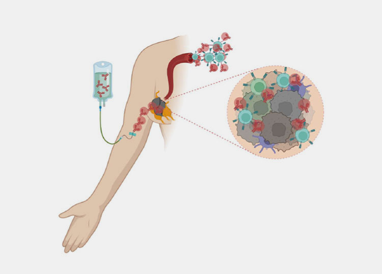 Immunotherapy