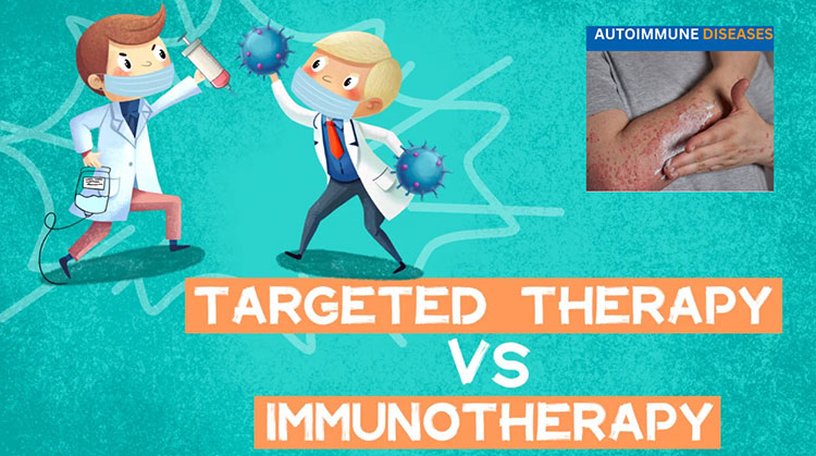 Ineligibility of the immunotherapy
