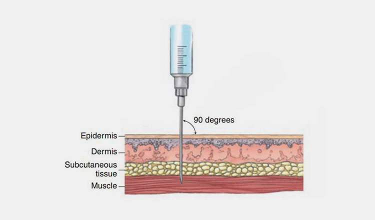 Intramuscular route