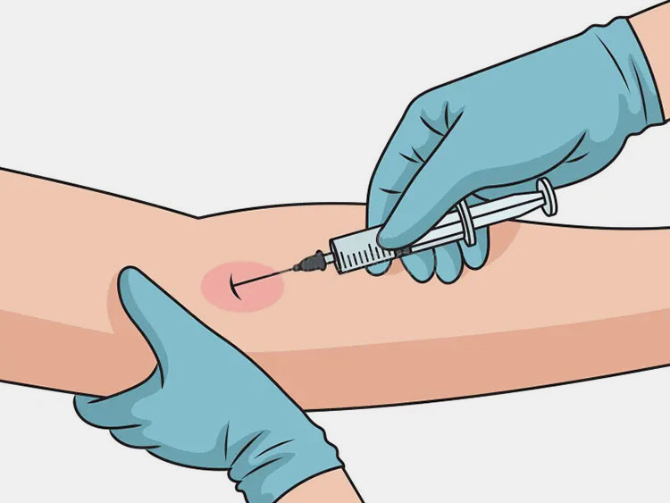 Intravenous administration