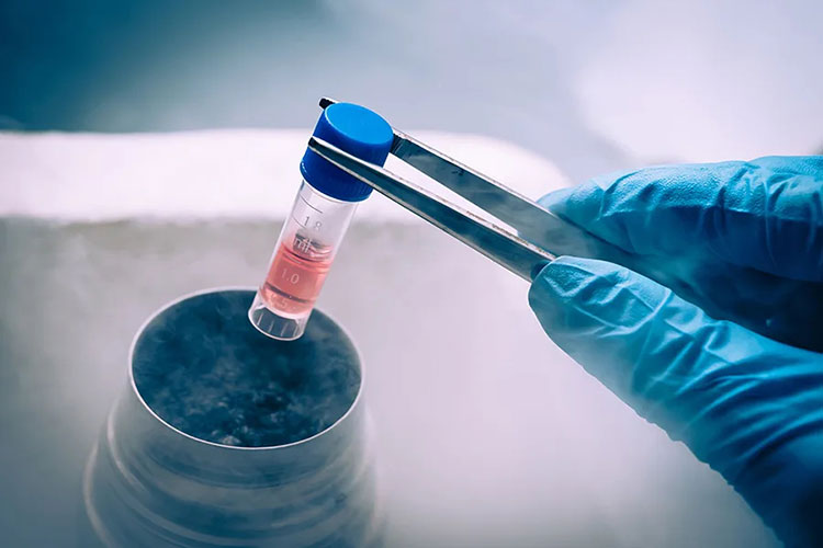 Keeping the cell structure sturdy