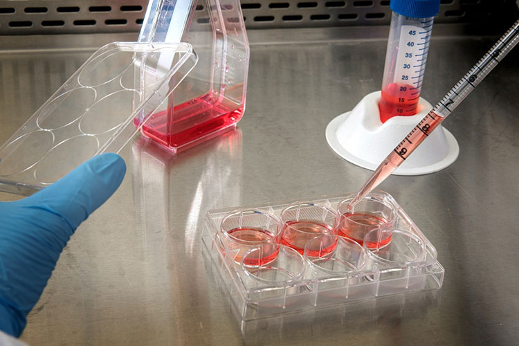 Limitation of Dmem for primary cells