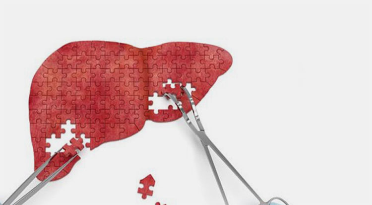 Liver Cancer
