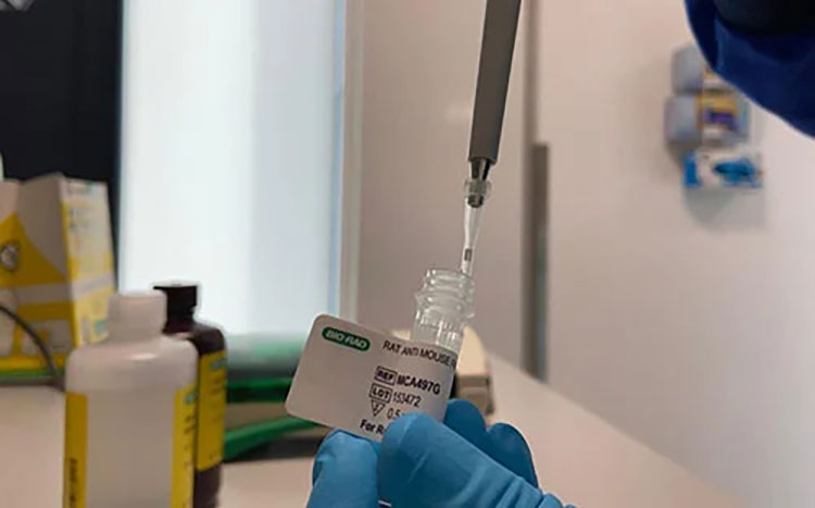 Long-Term Antibody Storage