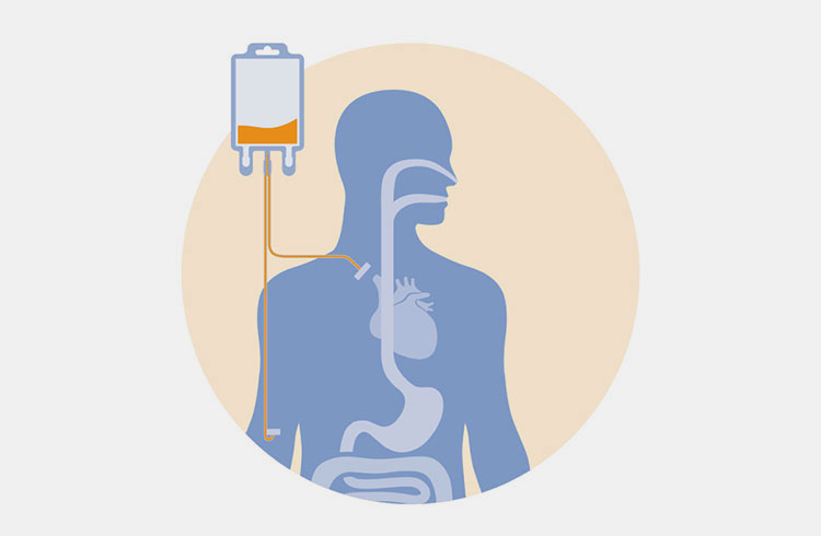 Parenteral Nutrition