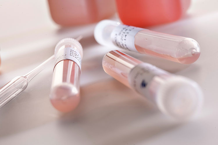 Polyclonal Antibodies