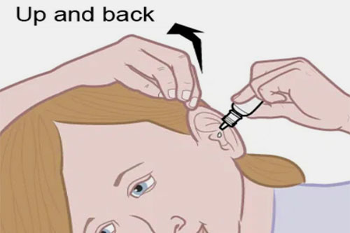 Position the head & administer drug