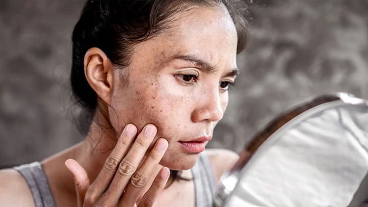 Protect against sun damage