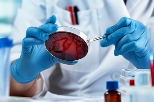 Protecting the viability of T cells