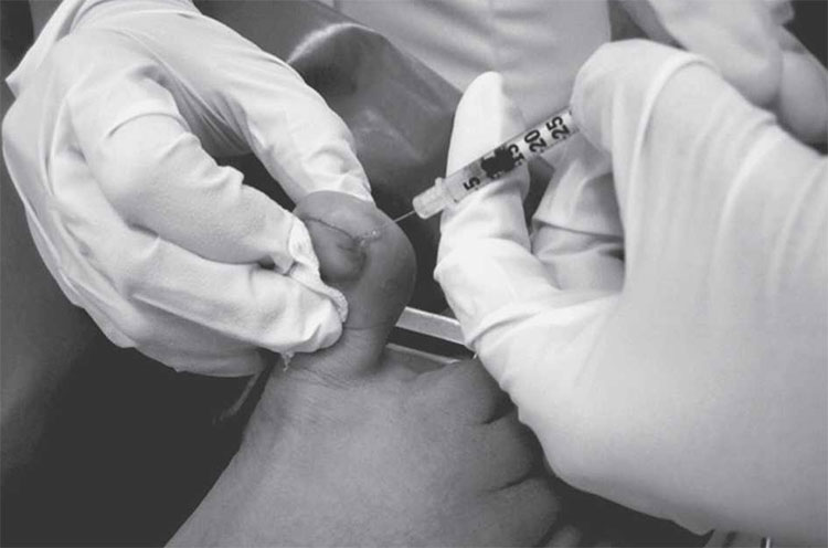 Rabies vaccine and rabies immunoglobuline
