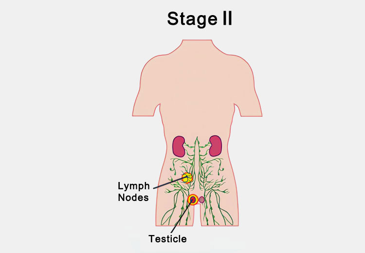 Second stage