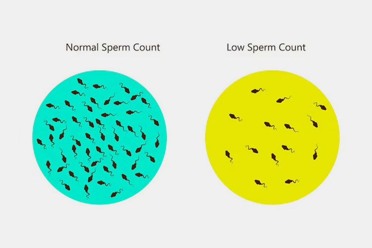 Sperm count