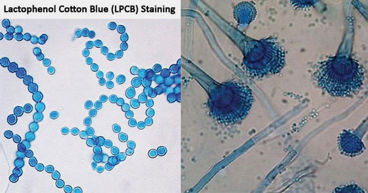 Structures identification