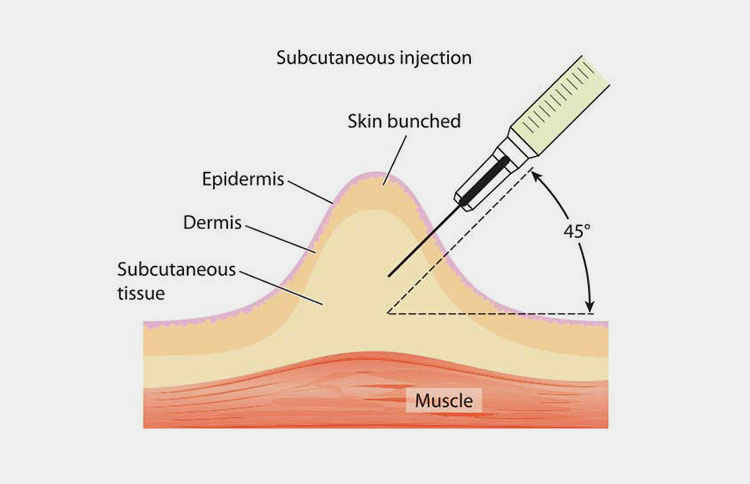 Subcutaneous route