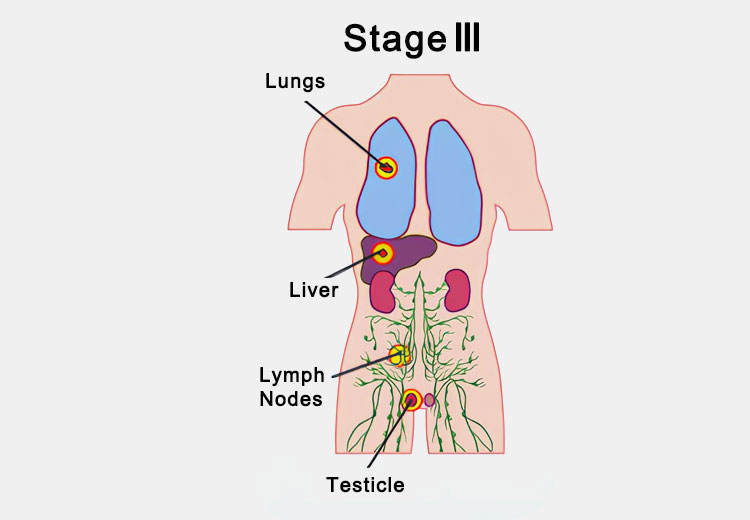 Third stage