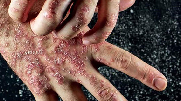 Understanding the process of diseases
