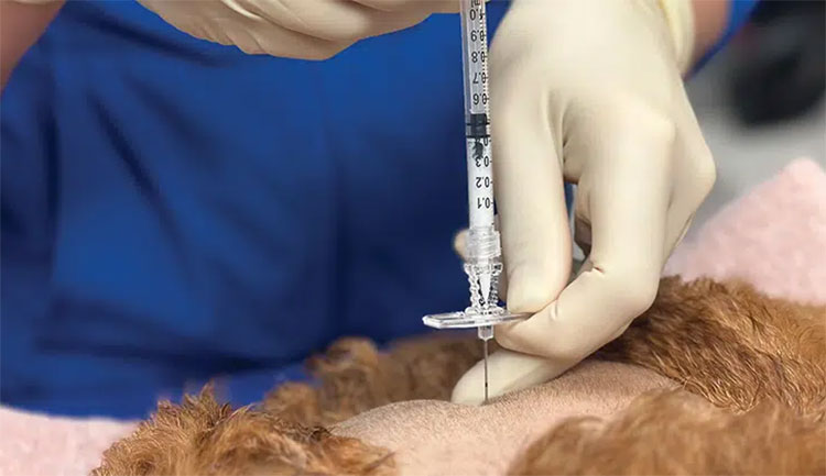 cerebrospinal fluid