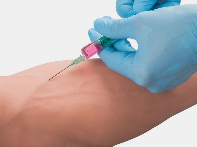 Administration of potassium chloride into the body
