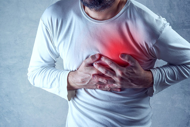 Angina