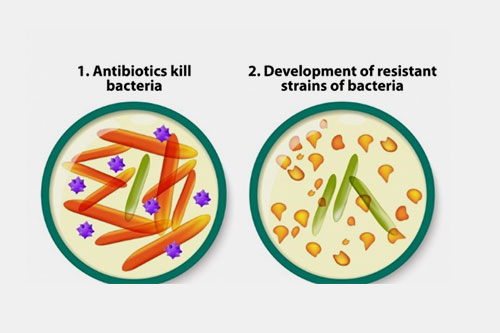 Development of antibiotic resistance